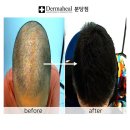 엠지에프두피탈모전문센터 분당점