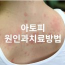 산들한의원 이미지