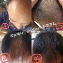 리뉴메디 이미지