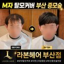 누구나 할 수 있는 헤어커트 | 부산 헤어증모술 덕분에 M자탈모 탈출 했어요