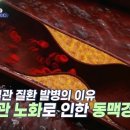 돌연사를 부르는 혈관 질환을 물리쳐라! 이미지