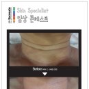 예인피부관리 이미지