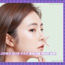 세종성형외과 코필러 고민하고 있다면 무조건 필독(코끝 와이코 설명)