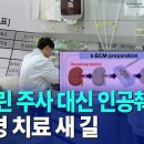 인슐린 주사 치료를 대체할 수 있는 인공췌장 기술을 개발 - TJB뉴스 이미지