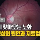 [내몸보고서] 내 눈에 찾아오는 노화…황반변성의 원인과 치료법 / YTN 사이언스 이미지