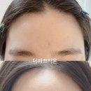 지윤헤어라인