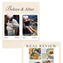 비영헬스케어 이미지