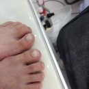 여름잇 | 울산 신정동 뜯는발톱 아크릴 여름 패디 추천 네일드잇