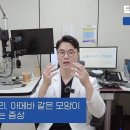 "눈에 뭐가 떠다닌다?" 실명 전 나타나는 전조증상 이미지