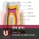 유어스치과의원 네이버블로그