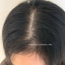 영지헤어 | 출산 후 탈모토닉추천 쓰리와우 가노더마 쿨링 토닉 • 영지버섯 헤어토닉 솔직후기