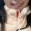 바른이치과 | 교정일기 2 | 하악발치 마스크 챙겨가요 제발. 발치교정 일주일 차 후기-오목교 여인호바른이교정치과