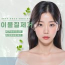 이물질제거 후기, 불법 성형시술 부작용 바로 치료하셔야 합니다.