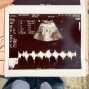 무궁화로+대산로31번길 | #10 임신 29주-31주 | 임당식단기록 3탄, 임신 후기 증상 기록