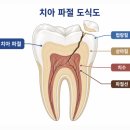 권순민 | 충치보다 무서운 범인, 혹시 모르고 계셨나요?(이 악물기)