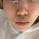 용인피부관리잘하는곳 보라뷰티기흥점 피코슈어토닝 후기