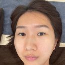 온포레 | 온포레 검단신도시 피부관리 후기