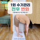 바른몸체형관리 | 시흥체형교정 시흥시바른몸체형교정원, 수기관리 전후 직접 비교한 후기