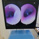 독일귀편한보청기 이미지