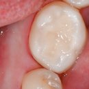 수영교차로 이미지