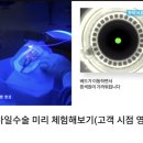 신세계안과의원 | 광주 신세계안과의원 - 스마일라식 : 내돈내산 시력교정술 후기