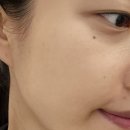 전농7 | 올가드림뷰티 전농점 :: PDRN 물광관리 솔직 후기