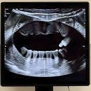 정성치과의원 | 이만하면 인생 치과 찾은 듯? 더정성치과의원 탐방기!