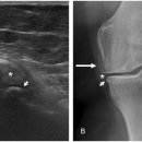 본큐어한의원 이미지