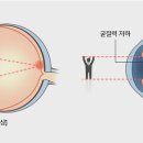강릉성모안과