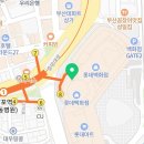 [연제일신병원]심부자궁내막증 수술후기_#16(퇴원 후 외래진료)