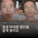 송리단길 작은얼굴 체형교정 | 목동마사지 모비연 체형교정 후기, 얼굴 비대칭 원인을 알게 됐어요