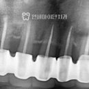 종로크라운 이미지