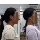 평촌 샘 골프 | 강소라가 증명한, 우리가 ‘거북목’을 고쳐야 하는 이유! 태안더리햅 실제 거북목 후기