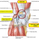 장경인대증후군 이미지