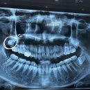 목포스마트원치과병원 이미지