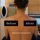 다온케어 | 망우역 에스테틱 추천｜라운드숄더·어깨통증 개선 다온미에스테틱 숄더밸런스케어 후기