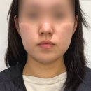 정바른자세연구소 - 서초구 서초대로 397 | 강남역 정바른자세연구소 안면비대칭 교정 후기, 가격, 다운타임, 사후관리, 내돈내산