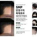 스칼프디자인센터 광주점 이미지