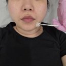 세라 | 부산 광안동 스킨플래닝 장인 멜로드뷰티 3세대 세라링 후기