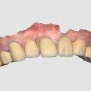 아인치과기공소 이미지