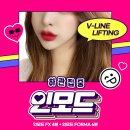 롤링제이(RollingJ)미래병원점 | 인모드리프팅레이저로 하관집중 케어하기