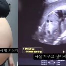 [속보] ‘36주 낙태’ 병원장·집도의 구속 면해… “현 단계서 구속 필요 없어” 이미지