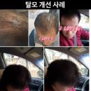 진크린 이미지