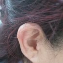 시그니아독일보청기대구북구센터 이미지