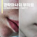 스킨포레 뉴턴케어 후기, 경락부작용으로 피부 뒤집어짐 (part.2)