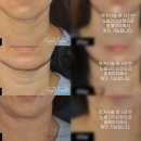 노블와이성형외과의원 이미지