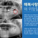 연세사랑니치과의원 이미지