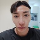 人디자인 | 여의도피부과 슈링크300샷 유지기간길고 효과즉각적 남자리얼후기