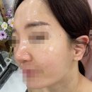 수원-1309 | 수원 헤드스파 피부관리샵 에스떼이브 뷰티케어 수원점 esV10모공디톡스 피지케어 후기