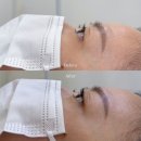 고운눈썹 | 일산 속눈썹 펌 추천｜고운눈썹 솔직후기